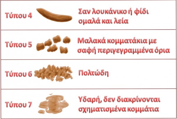 Σχήμα και μορφή κοπράνων ταξινόμηση κατά Bristol stools2.jpg